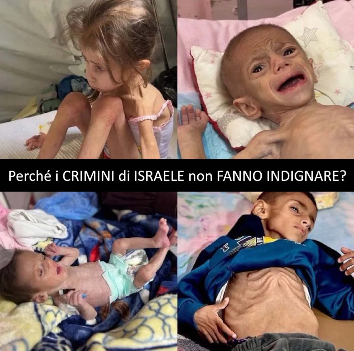 UNICEF e WFP: 71.000 bambini e più di 17.000 madri sono minacciati da malnutrizione acuta